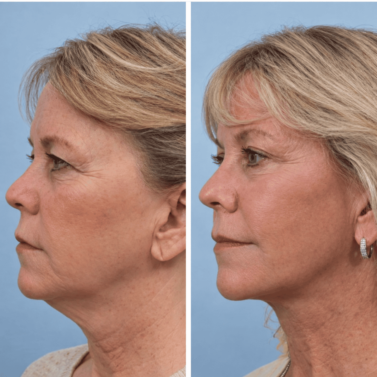 Cepillo Facial Aunia™