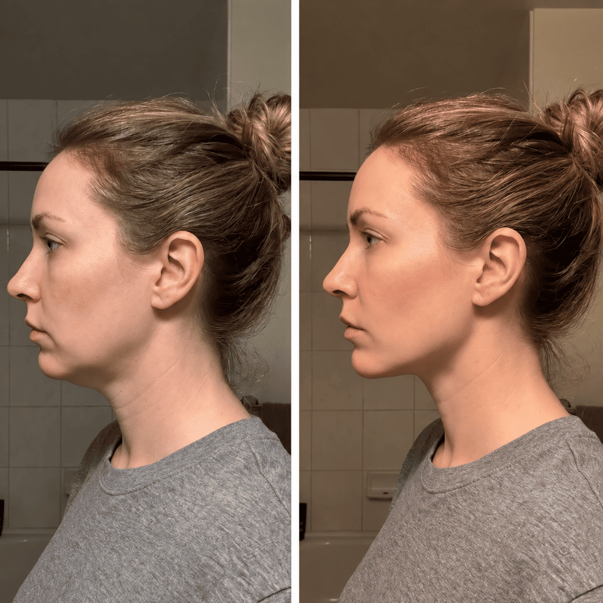 Cepillo Facial Aunia™