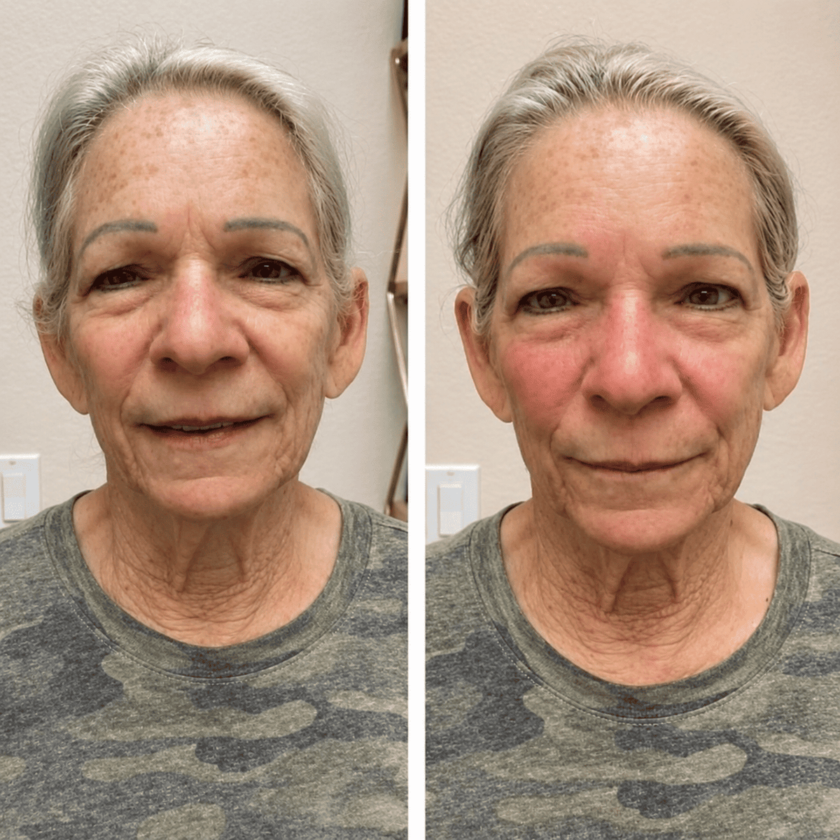 Cepillo Facial Aunia™