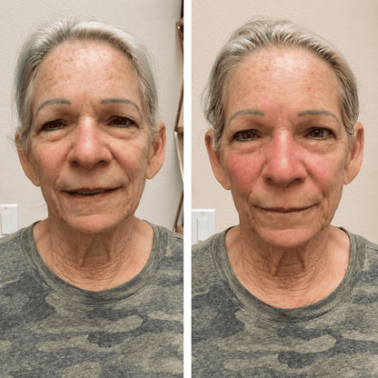 Cepillo Facial Aunia™