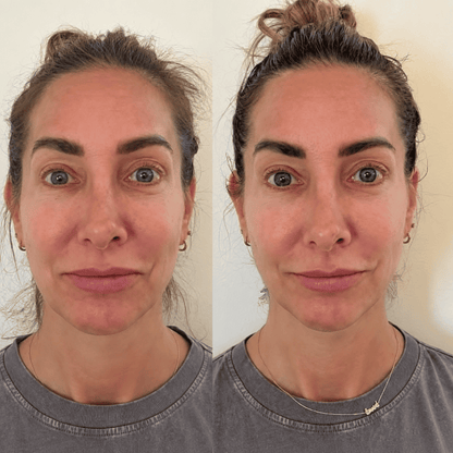 Cepillo Facial Aunia™