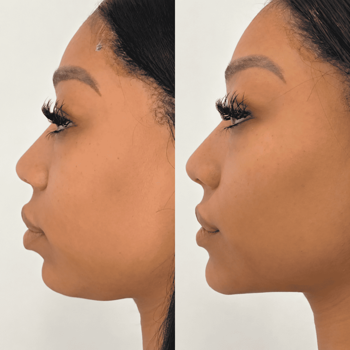 Cepillo Facial Aunia™