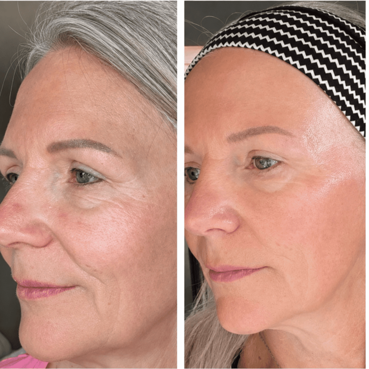 Cepillo Facial Aunia™