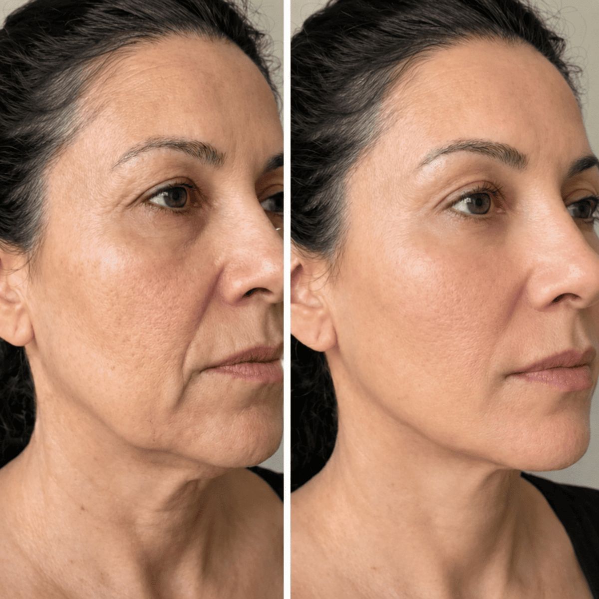 Cepillo Facial Aunia™